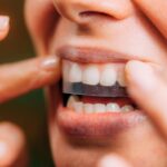 Os compradores da Amazon juram que viram uma ‘grande diferença’ depois de usar essas tiras de clareamento