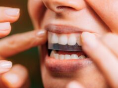 Os compradores da Amazon juram que viram uma ‘grande diferença’ depois de usar essas tiras de clareamento Os compradores da Amazon juram que viram uma ‘grande diferença’ depois de usar essas tiras de clareamento