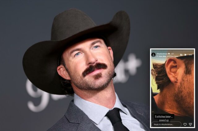 Riley Green ficou sangrando depois que um fã jogou o telefone em uma estrela country no palco durante o show
