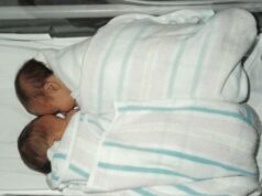 Sasha fez um teste de DNA de ancestralidade como uma diversão para aprender sobre sua herança – em vez disso, ela e sua irmã gêmea descobriram uma verdade bombástica sobre sua mãe tão rara que só houve outro caso na Austrália Sasha e sua irmã gêmea (acima) foram implantadas na mãe errada como embriões de fertilização in vitro