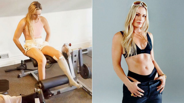 Simplesmente Vonnderful! Lindsey Vonn desafia todas as probabilidades com uma recuperação extremamente rápida
