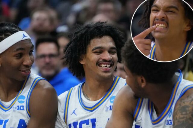 Skyy Clark, da UCLA, perde parte do dente em um O jogador de basquete da UCLA, Skyy Clark, sorri sem um dente da frente e com sangue na gengiva.