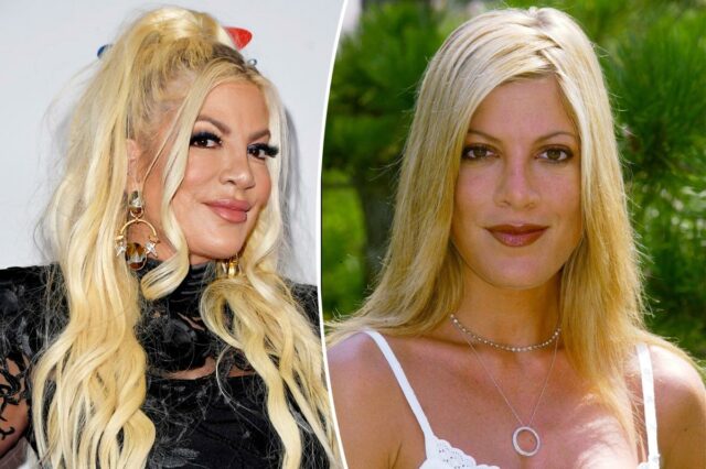 Tori Spelling bate recorde direto em preenchimentos após comentários ‘horríveis’ sobre sua aparência
