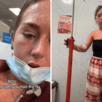 Achei que tinha acabado de pegar uma gripe - então notei uma erupção na pele por todo o meu corpo