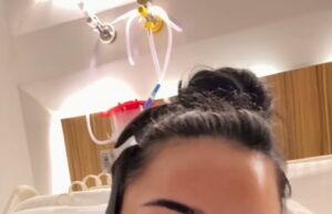 Andrada Pop, de Love Island, 27 anos, passa por uma lipoaspiração no ‘queixo teimoso e na gordura do braço’ depois de voltar para a Turquia seis meses após uma plástica nos seios Andrada Pop passou por mais procedimentos cosméticos na Turquia quando voltou ao país esta semana, apenas seis meses após a cirurgia nos seios