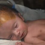 As baixas invisíveis de Gaza: um aumento no número de nados-mortos e de defeitos congénitos