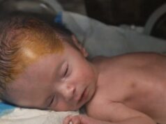 As baixas invisíveis de Gaza: um aumento no número de nados-mortos e de defeitos congénitos As baixas invisíveis de Gaza: um aumento no número de nados-mortos e de defeitos congénitos