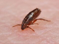 Autoridades de saúde relatam número recorde de casos de tifo potencialmente fatais: “Todos estão em risco” Yahoo news home