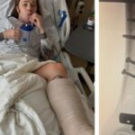 Billy Strings quebra a perna em dois lugares enquanto andava de skate durante o intervalo do encore: 'Eu ouvi isso estalar sobre a multidão gritando!'