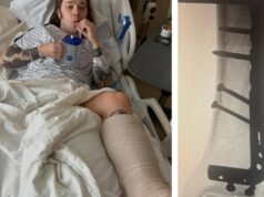 Billy Strings quebra a perna em dois lugares enquanto andava de skate durante o intervalo do encore: ‘Eu ouvi isso estalar sobre a multidão gritando!’ Billy Strings quebra a perna em dois lugares enquanto andava de skate durante o intervalo do encore: 'Eu ouvi isso estalar sobre a multidão gritando!'