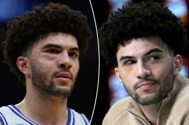 Cameron Boozer sofreu múltiplas fraturas faciais na derrota do Duke's Eight para a UConn
