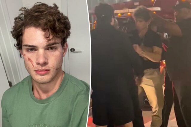 Clavicular, influenciador de 'Looksmaxxing', aborda hospitalização 'brutal' após suspeita de overdose em transmissão ao vivo
