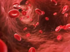 Dia Mundial da Hemofilia: Por que as mulheres com hemofilia ainda são mal diagnosticadas Dia Mundial da Hemofilia: Por que as mulheres com hemofilia ainda são mal diagnosticadas