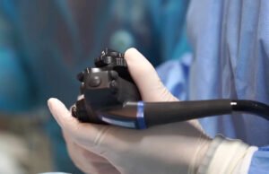 Estudo constata aumento de mortes por câncer retal em adultos mais jovens Yahoo news home