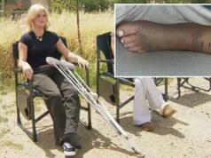 Garota de SoCal, de 14 anos, revela ferimentos horríveis depois que uma cascavel quase a matou: ‘Minha audição foi interrompida’ Garota de SoCal, de 14 anos, revela ferimentos horríveis depois que uma cascavel quase a matou: ‘Minha audição foi interrompida’