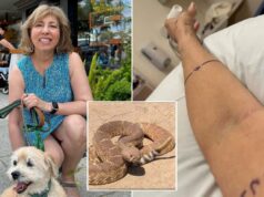 Imagens horríveis mostram as consequências da picada de cascavel – enquanto a vítima fala Imagens horríveis mostram as consequências da picada de cascavel – enquanto a vítima fala