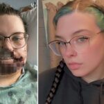 Mãe de Illinois fica com o rosto despedaçado por cão de resgate após sofrer convulsão