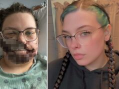 Mãe de Illinois fica com o rosto despedaçado por cão de resgate após sofrer convulsão Mãe de Illinois fica com o rosto despedaçado por cão de resgate após sofrer convulsão