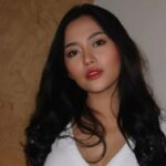 Mata Rachel Vennya Lebam Internauta Tuding Okin, Ini Fakta Sebenarnya!