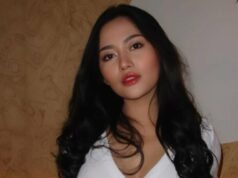 Mata Rachel Vennya Lebam Internauta Tuding Okin, Ini Fakta Sebenarnya! Mata Rachel Vennya Lebam Internauta Tuding Okin, Ini Fakta Sebenarnya!