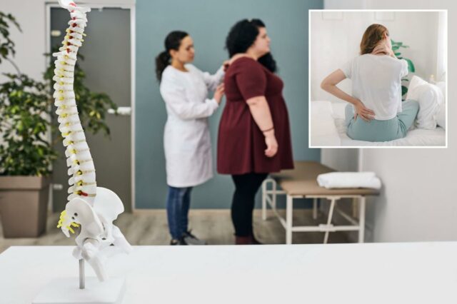 Médicos expõem ‘corcova de búfalo’ como sinal potencial de problemas Médicos expõem ‘corcova de búfalo’ como sinal potencial de problemas de saúde ocultos