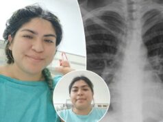 Mulher descobre que falta de piercing no nariz viajou para os pulmões, causando tosse que durou um mês Mulher descobre que falta de piercing no nariz viajou para os pulmões, causando tosse que durou um mês