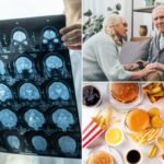 O risco de demência aumenta com o tipo de alimento comum que milhões de pessoas comem todos os dias, sugere estudo