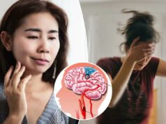 Os sutis sinais de alerta de um ‘mini acidente vascular cerebral’ – e quem corre maior risco Os sutis sinais de alerta de um ‘mini acidente vascular cerebral’ – e quem corre maior risco