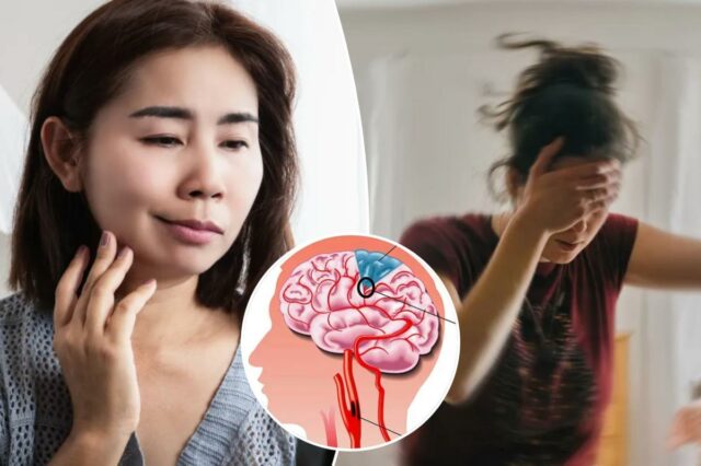 Os sutis sinais de alerta de um ‘mini acidente vascular cerebral’ – e quem corre maior risco
