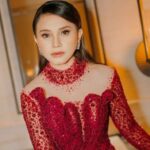 Rossa Sakit Hati Dituduh Gagal Oplas, Psikisnya Jadi Terganggu