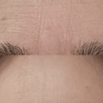 Rugas entre as sobrancelhas? Esta correção de 3 minutos leva anos