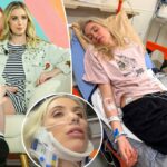 A comediante Laura Clery ‘gravemente ferida’ depois de ser ‘presa’ pela geladeira em um acidente ‘aterrorizante’