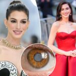 A condição médica secreta de Anne Hathaway que durou uma década a deixou quase cega aos 30 anos