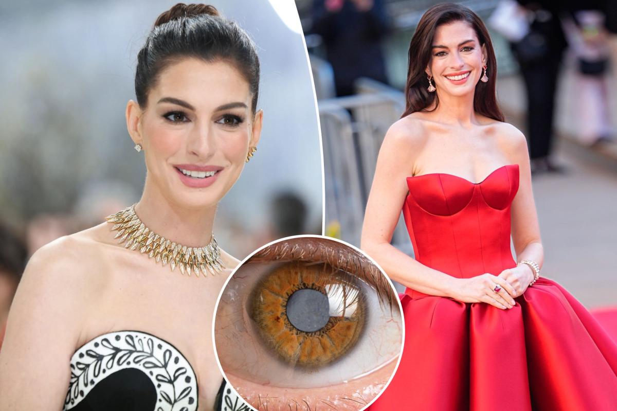A condição médica secreta de Anne Hathaway que durou uma década a deixou quase cega aos 30 anos