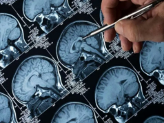 AIIMS Delhi apresenta o primeiro sistema de ressonância magnética portátil de cabeceira AIIMS Delhi apresenta o primeiro sistema de ressonância magnética portátil de cabeceira