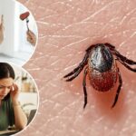 Alergias à carne, confusão, vômitos – 5 doenças que você pode pegar por carrapatos quando as visitas ao pronto-socorro aumentam