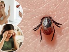 Alergias à carne, confusão, vômitos – 5 doenças que você pode pegar por carrapatos quando as visitas ao pronto-socorro aumentam Alergias à carne, confusão, vômitos – 5 doenças que você pode pegar por carrapatos quando as visitas ao pronto-socorro aumentam