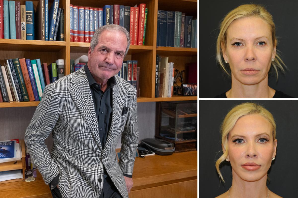 Beleza relativa: o cirurgião plástico de Nova York operou toda a sua família - e até fez uma plástica nos seios da irmã