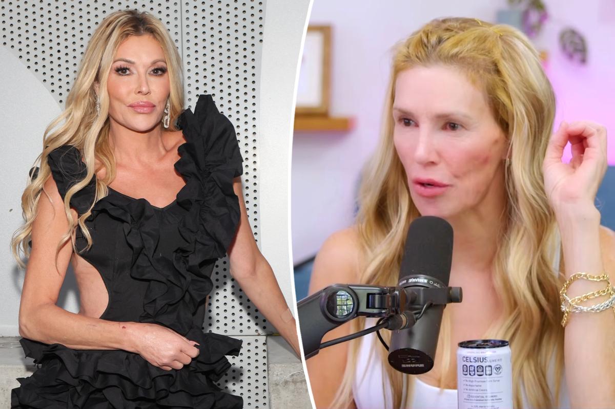 Brandi Glanville acha que tem uma ‘micose sexualmente transmissível’ na garganta em meio a problemas de saúde contínuos