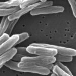 CDC alerta que grandes surtos de tuberculose duplicaram nos EUA desde meados da década de 2010