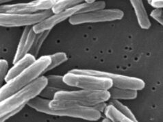 CDC alerta que grandes surtos de tuberculose duplicaram nos EUA desde meados da década de 2010 CDC alerta que grandes surtos de tuberculose duplicaram nos EUA desde meados da década de 2010