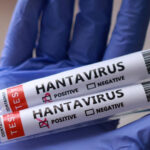 Deveríamos estar preocupados com o surto de hantavírus?