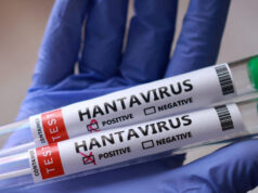 Deveríamos estar preocupados com o surto de hantavírus? Deveríamos estar preocupados com o surto de hantavírus?