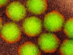 Doença contagiosa não vista na Austrália há mais de 50 anos detectada Micrografia eletrônica de transmissão colorida de partículas de poliovírus.