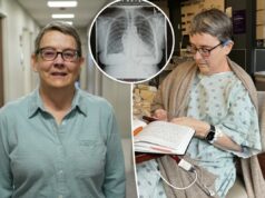 Engenheira da NASA passa por transplante duplo de pulmão inovador – agora ela está livre do câncer Engenheira da NASA passa por transplante duplo de pulmão inovador – agora ela está livre do câncer