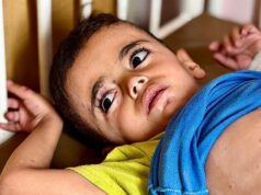 Erupções cutâneas semelhantes a queimaduras e fome: as crianças de Gaza enfrentam crise de doenças de pele Yasser Arafat, de seis anos, em uma cama de hospital no Hospital Nasser, Khan Younis