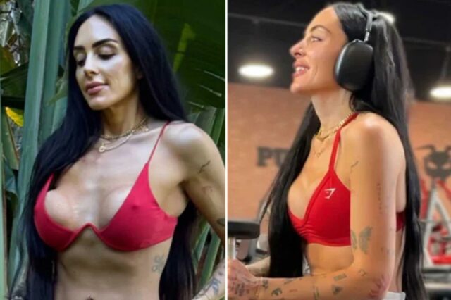 Cheyenne Caspary com implantes musculares.