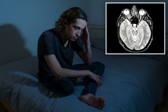 Ficar acordado a noite toda pode encher seu cérebro com proteínas do Alzheimer – por que isso pode criar um ciclo vicioso para os idosos
