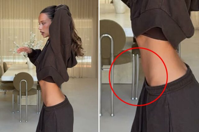 Influenciador destruído por aparentemente manipular a foto para achatar a Influenciador destruído por aparentemente manipular a foto para achatar a barriga - com resultado bizarro: 'Meu Deus, isso é uma loucura'