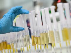 Ministério do Esporte propõe emendas para punir sindicatos de doping organizados com até 10 anos de prisão Ministério do Esporte propõe emendas para punir sindicatos de doping organizados com até 10 anos de prisão